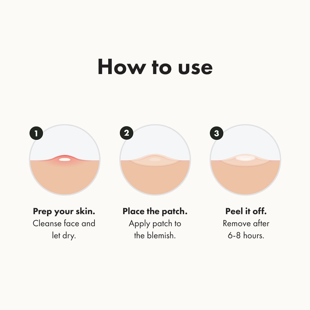 Hydrocolloid Acne Pimple Patch – Shrinks Zits & Whiteheads Overnight (72/32 Count)