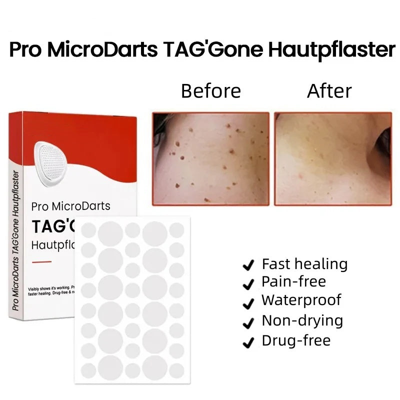 50% Off🌟Pro MicroDarts Skin Tag Removal Patch