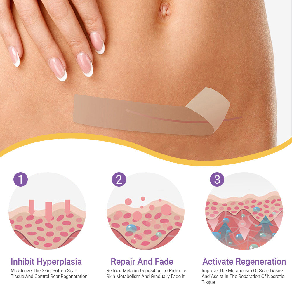 ✅Official Store|Hyaluronic Acid Nano Microneedle Repair Tape🏥(Treatment of old and new scars, reduction of surgical scars, stretch marks, keloids, acne, burns, warts, dermatomes and varicose veins)