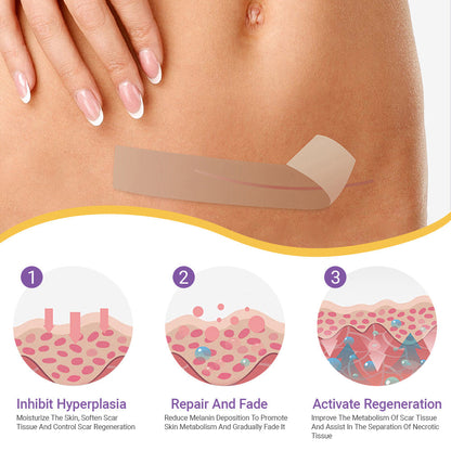 ✅Official Store|Hyaluronic Acid Nano Microneedle Repair Tape🏥(Treatment of old and new scars, reduction of surgical scars, stretch marks, keloids, acne, burns, warts, dermatomes and varicose veins)