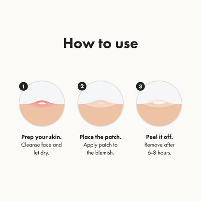 Hydrocolloid Acne Pimple Patch – Shrinks Zits & Whiteheads Overnight (72/32 Count)