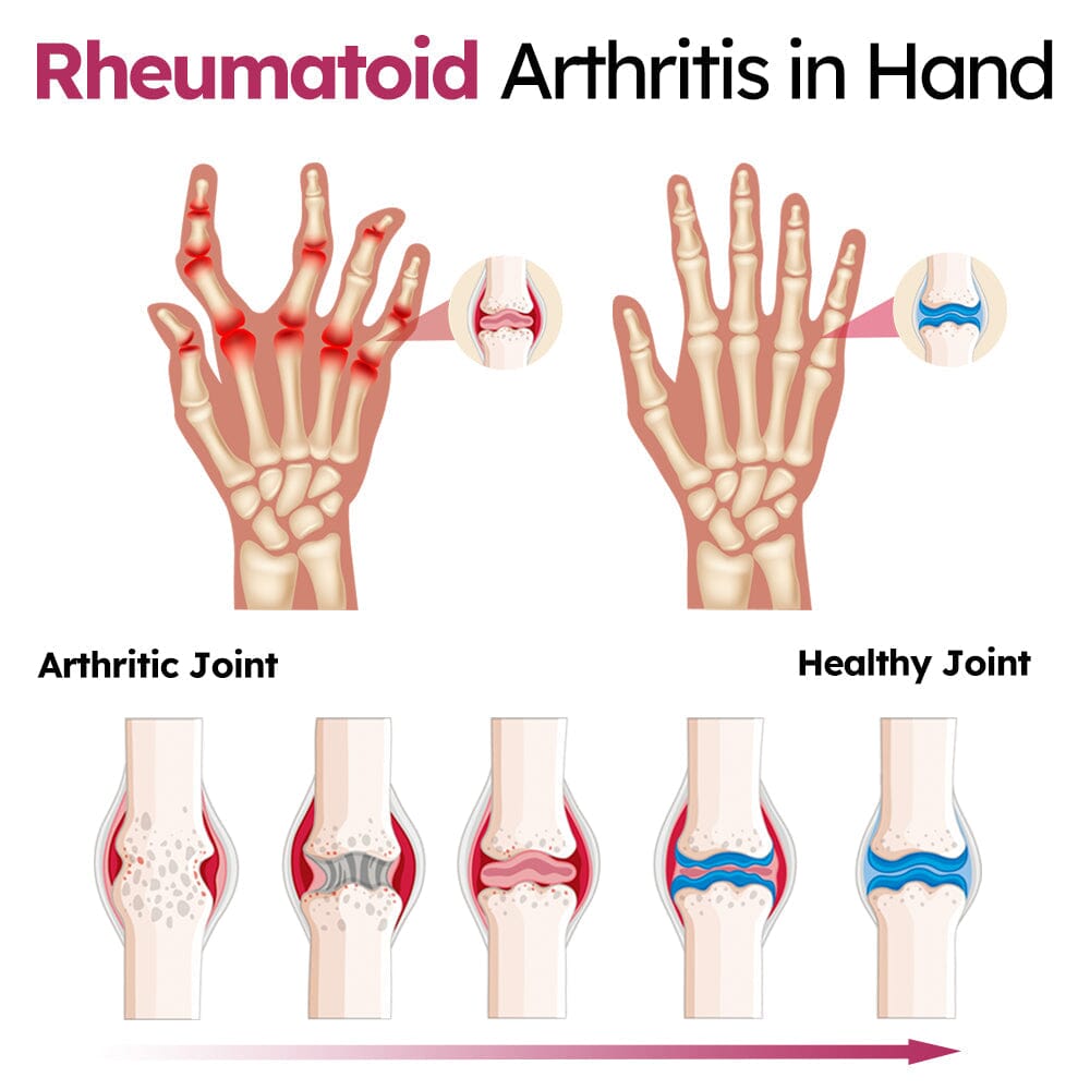 Dark Fairy Joint and Bone Recovery Cream