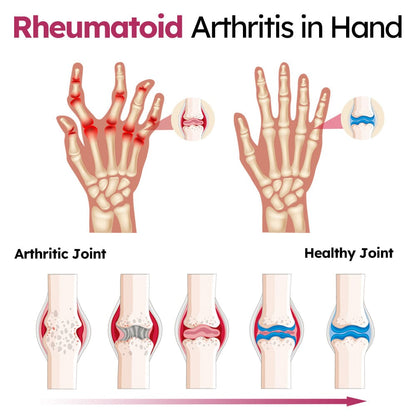 Dark Fairy Joint and Bone Recovery Cream