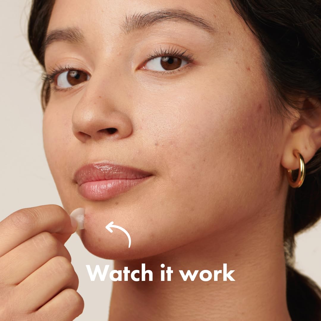 Hydrocolloid Acne Pimple Patch – Shrinks Zits & Whiteheads Overnight (72/32 Count)