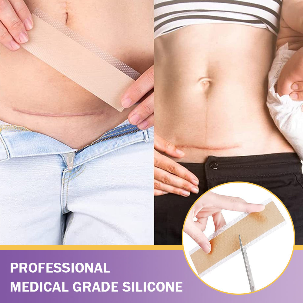 ✅Official Store|Hyaluronic Acid Nano Microneedle Repair Tape🏥(Treatment of old and new scars, reduction of surgical scars, stretch marks, keloids, acne, burns, warts, dermatomes and varicose veins)