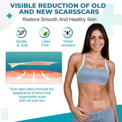 [Buy one get one free]Silicone Scar Sheets,Silicone Scar Repair Cream,Silicone Scar Tape, Silicone Scar Strips, Professional Scar Removal Sheets for Surgical Scars, Keloid, C-Section, Burn et