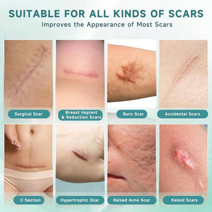 [Buy one get one free]Silicone Scar Sheets,Silicone Scar Repair Cream,Silicone Scar Tape, Silicone Scar Strips, Professional Scar Removal Sheets for Surgical Scars, Keloid, C-Section, Burn et
