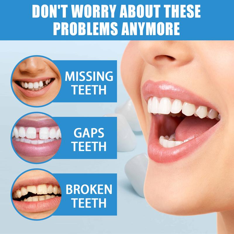 Temporary Tooth Filling Kit – Moldable Dental Gel for Quick Fixes, Cavities, Cracked or Missing Teeth | DIY Temporary Denture Replacement