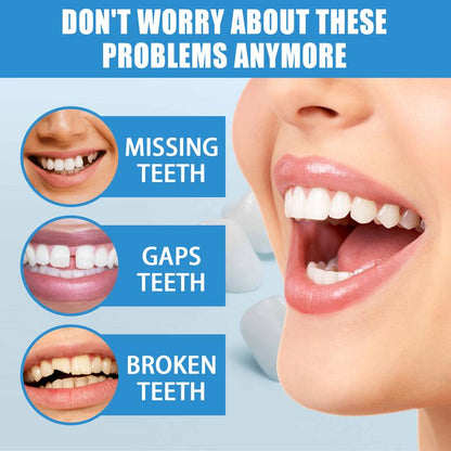 Temporary Tooth Filling Kit – Moldable Dental Gel for Quick Fixes, Cavities, Cracked or Missing Teeth | DIY Temporary Denture Replacement